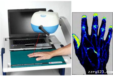 散斑全帧实时扫描成像系统